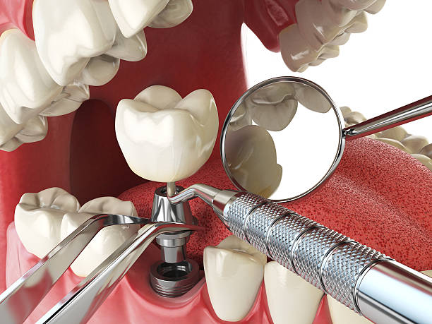 Best Emergency Denture Repair in Burnham, IL